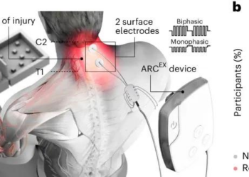 脑机接口第一股来了，「DeepSeek时刻」还没来